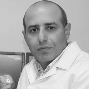 Aydin Mirzəyev